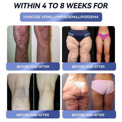 𝑶𝒇𝒇𝒊𝒄𝒊𝒂𝒍 𝑺𝒕𝒐𝒓𝒆⑤ |𝐂𝐯𝐫𝐞𝐨𝐳®𝟏𝟒-𝐢𝐧-𝟏 𝐌𝐚𝐠𝐧𝐞𝐬𝐢𝐮𝐦 𝐆𝐮𝐦𝐦𝐢𝐞𝐬(𝐉𝐮𝐬𝐭 𝐨𝐧𝐜𝐞 𝐚 𝐝𝐚𝐲, 𝐯𝐢𝐬𝐢𝐛𝐥𝐞 𝐜𝐡𝐚𝐧𝐠𝐞𝐬 𝐢𝐧 𝟕 𝐝𝐚𝐲𝐬)𝐅𝐨𝐫 𝐨𝐛𝐞𝐬𝐢𝐭𝐲, 𝐜𝐚𝐫𝐝𝐢𝐨𝐯𝐚𝐬𝐜𝐮𝐥𝐚𝐫 𝐡𝐞𝐚𝐥𝐭𝐡, 𝐝𝐢𝐚𝐛𝐞𝐭𝐞𝐬, 𝐬𝐥𝐞𝐞𝐩 𝐚𝐩𝐧𝐞𝐚, 𝐆𝐮𝐭 𝐇𝐞𝐚𝐥𝐭𝐡, 𝐣𝐨𝐢𝐧𝐭 𝐢𝐬𝐬𝐮𝐞𝐬, 𝐚𝐧𝐝 𝐦𝐨𝐫𝐞